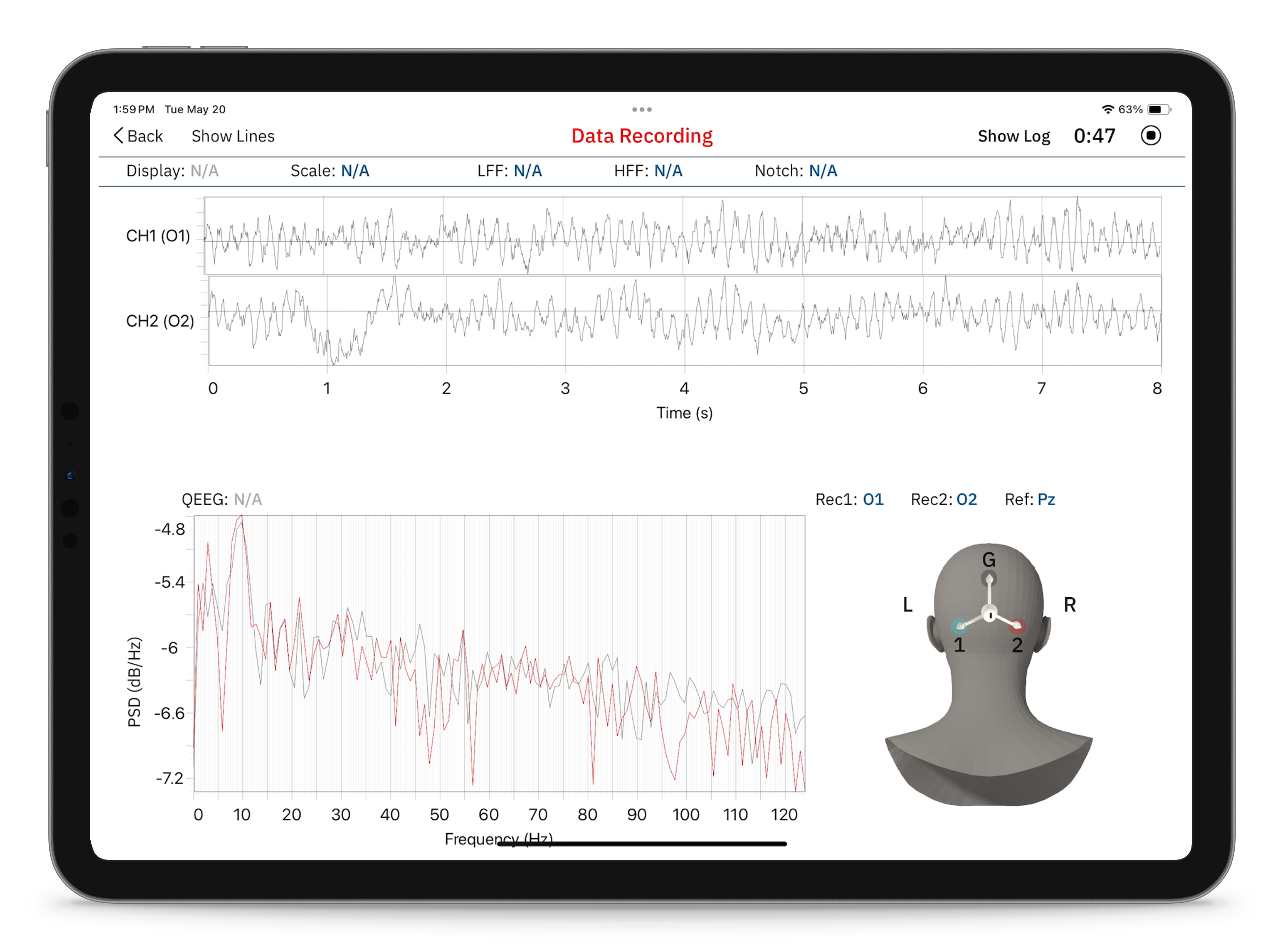 iPad showing EEG data interface
